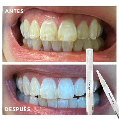 Smile White™ — El Lápiz Blanqueador 4X Más Potente (Promo 2x1)