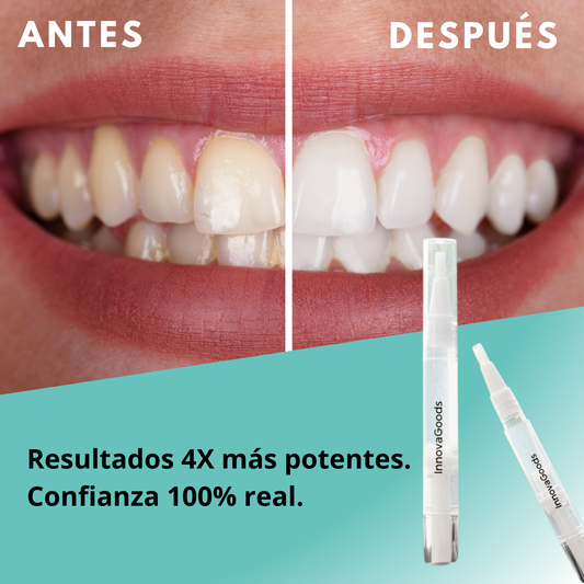 Smile White™ — El Lápiz Blanqueador 4X Más Potente (Promo 2x1)