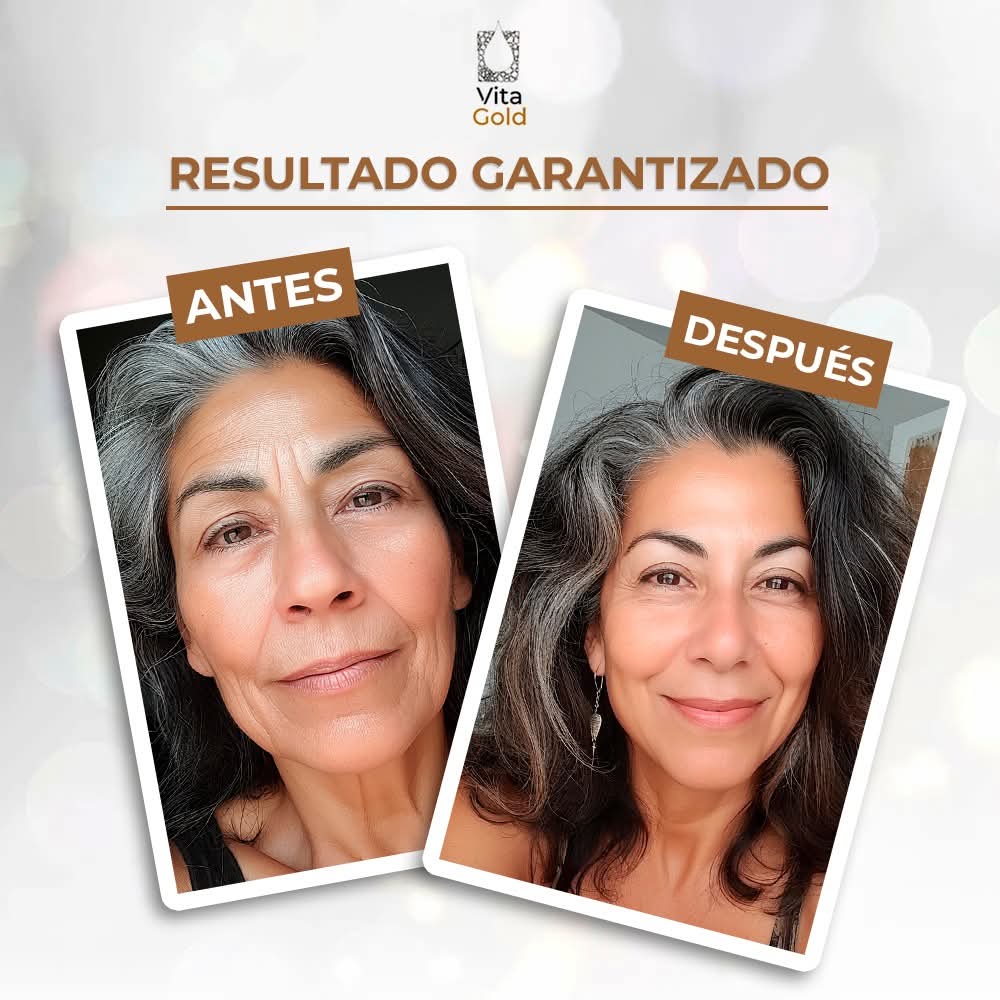 Vitagold – Renovación Visible en Solo Minutos